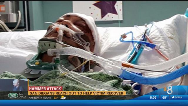 En coma inducido hombre herido a martillazos en San Diego; sandieguinos se unen