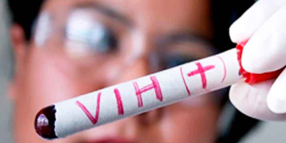 Registran caso de VIH en estudiante de secundaria