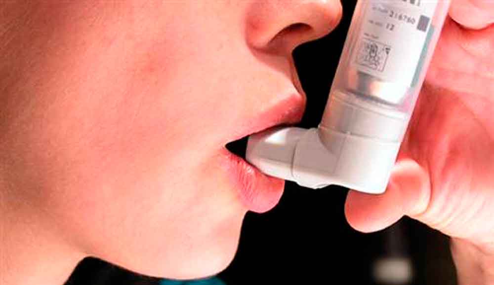 El asma es prevenible: IMSS