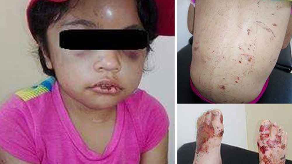 Indigna caso de niña torturada en Sonora; apuntan que es una menor robada en 2010