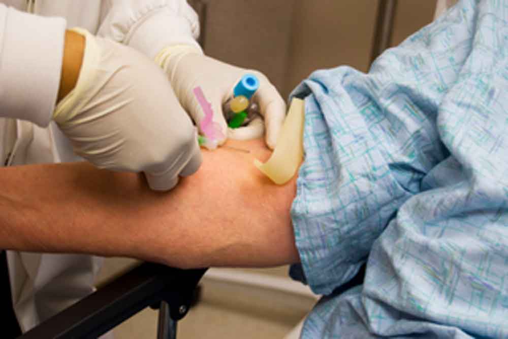 Se reportan 20 casos más de Hepatitis A en San Diego