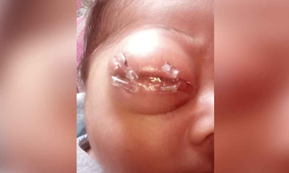 Bebé nace con cáncer en un ojo; familiares piden ayuda para su tratamiento
