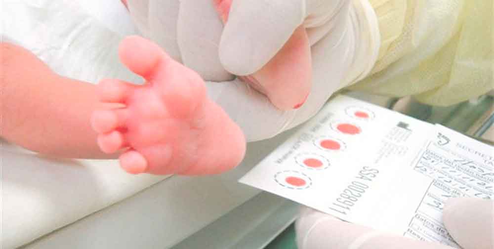 Exhortan a realizar la prueba de tamiz metabólico en recién nacidos