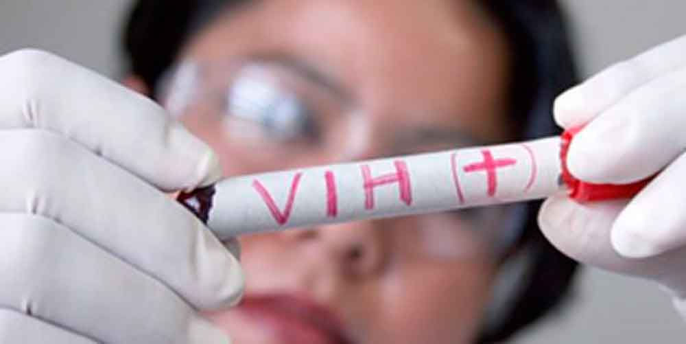 Suman 40 muertes en Mexicali por VIH