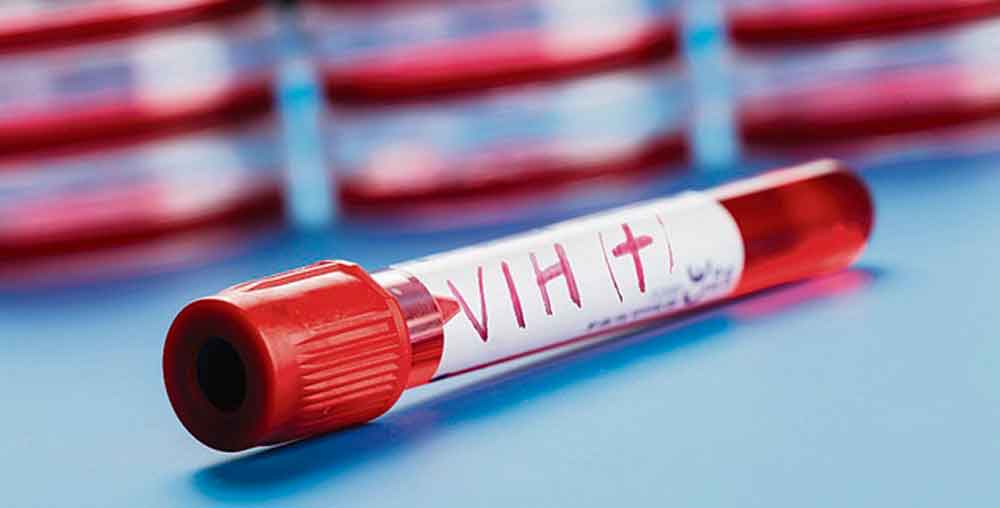 Se dispara epidemia de VIH en Europa: OMS