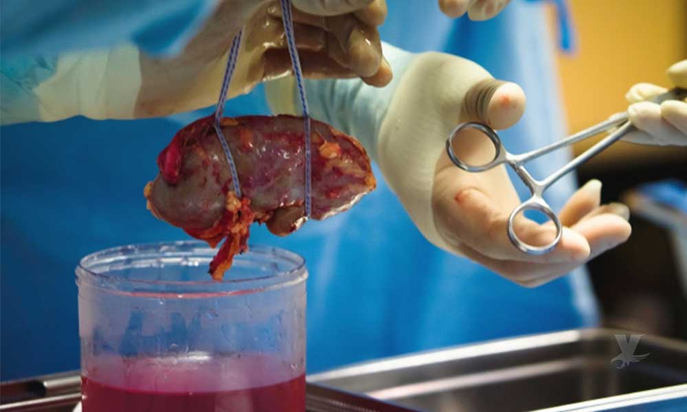 Hay 140 personas en lista de espera para recibir un órgano en Baja California; El riñón es el más solicitado