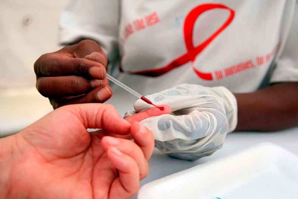 Falso médico contagia el virus del sida a 21 personas