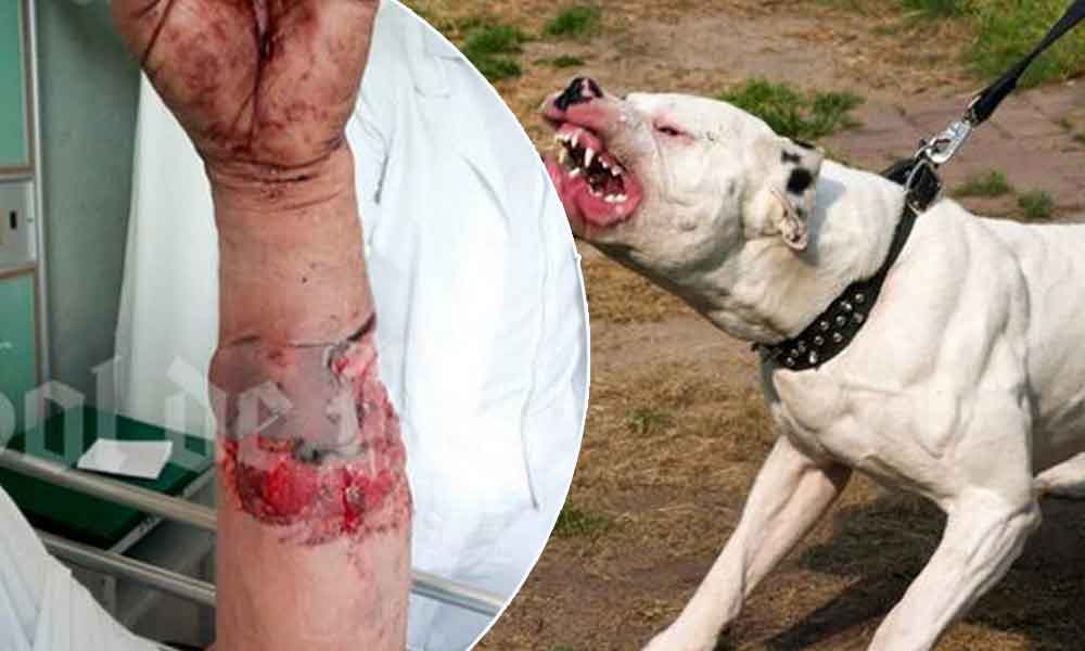 ¡Feroz ataque! Perros pitbull destrozan a anciano en Puebla
