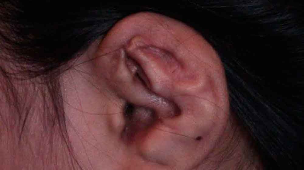 Mujer maltrataba a su hijastra: quemó sus genitales y deformó su oreja
