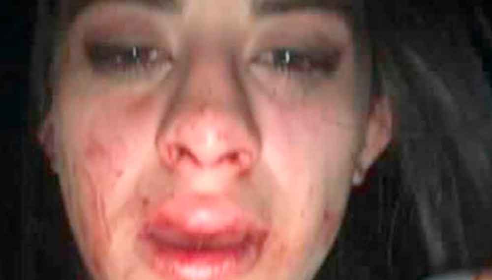 Joven denuncia golpiza de su novio, el hijo de un conductor de Televisa