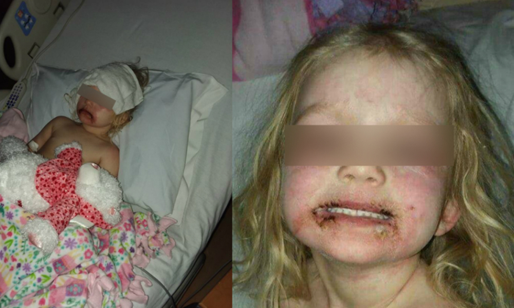 Niña usa maquillaje infantil y termina en el hospital; madre advierte en redes