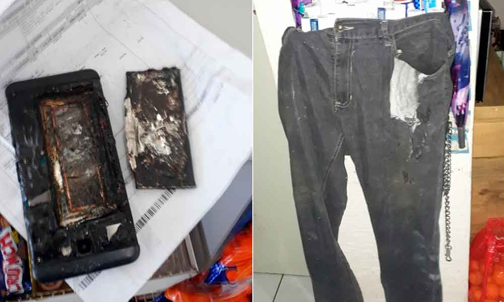 La batería del celular le explotó en la bolsa del pantalón, sufrió quemaduras de segundo grado