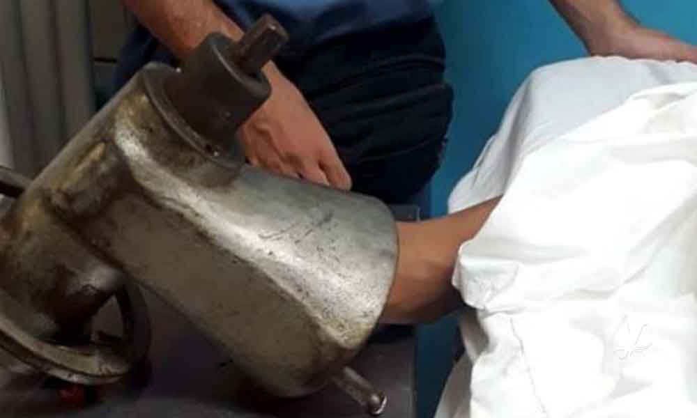Niño sufre amputación de una mano en una carnicería al quedarle atorada en molino eléctrico