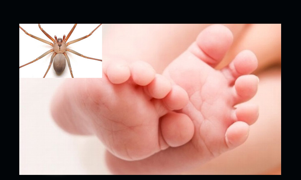 Amputarán pierna a bebé mordido por una araña violinista