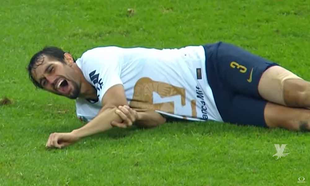 (VIDEO) Alejandro Arribas de Pumas sufre impresionable fractura en el codo y estará fuera un mes