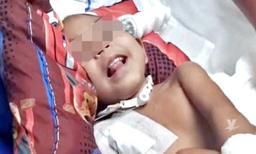 Niño de 5 años recibió un impacto de bala en la cabeza cuando dormía en brazos de su padre