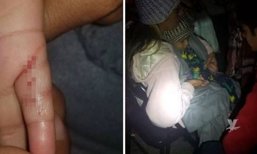 Bebé de la ‘Caravana Migrante’ es mordido por una rata en El Chaparral