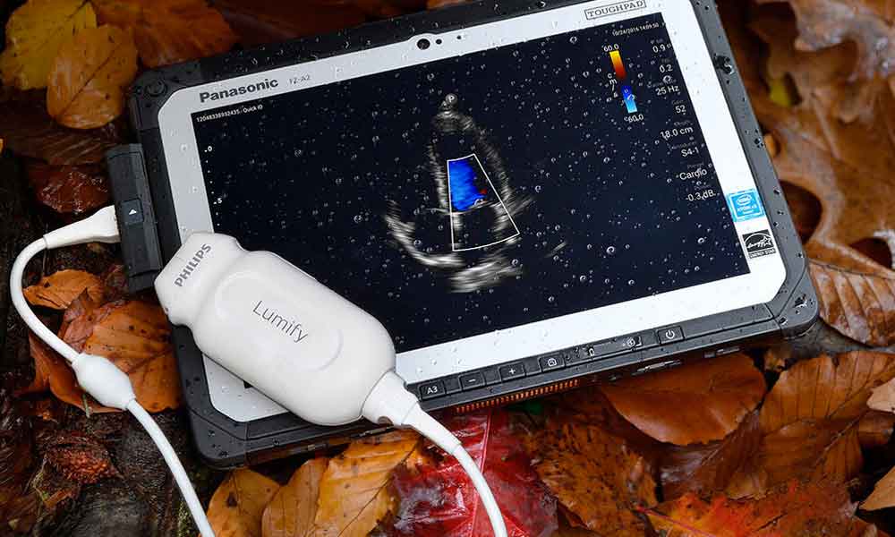 ¿Embarazada? Este aparato te permite realizar ultrasonidos en tú celular