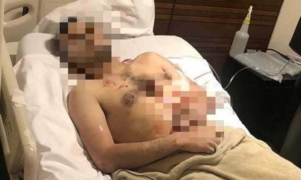 Hombre armado ingresó a hospital para rematar a un hombre que llegó herido en Tijuana