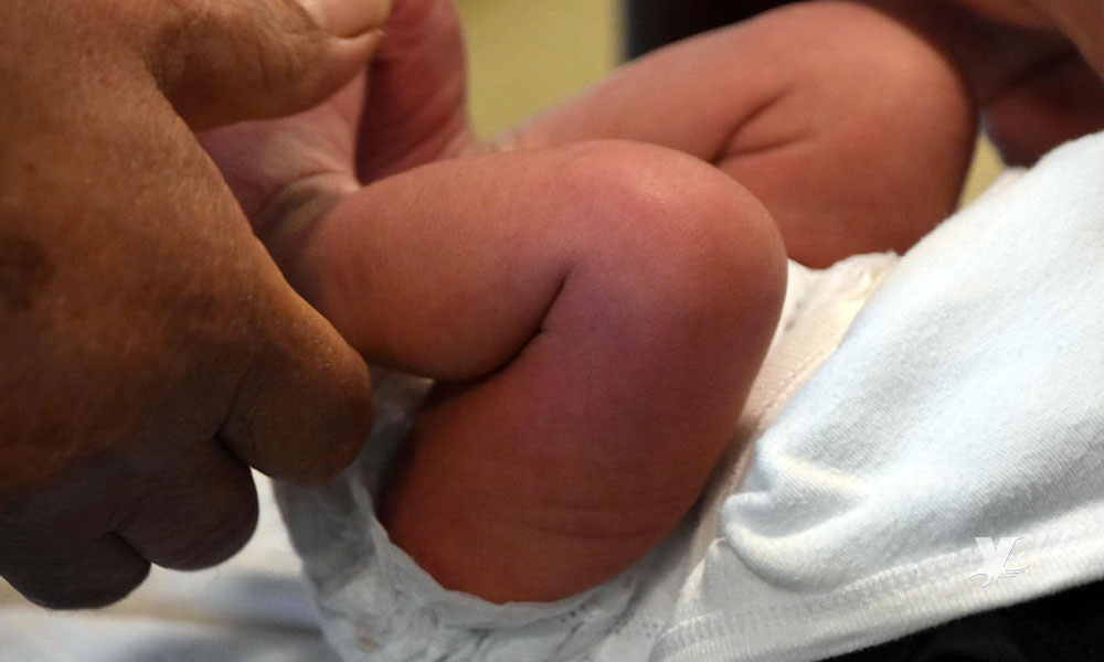 Bebé muere porque su madre le realiza circuncisión casera