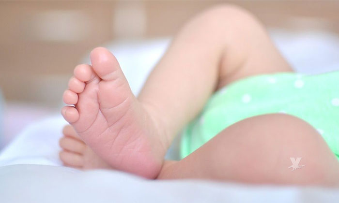 Nace bebé con ausencia de piel en varias partes de su cuerpo