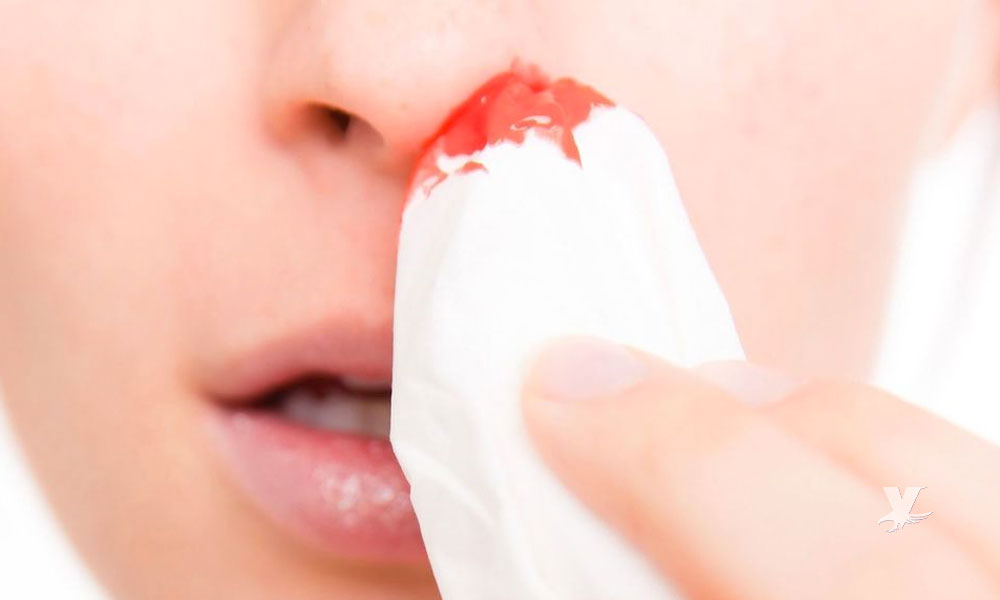 ¿Te sangra la nariz repentinamente? Podrías tener problemas graves de salud