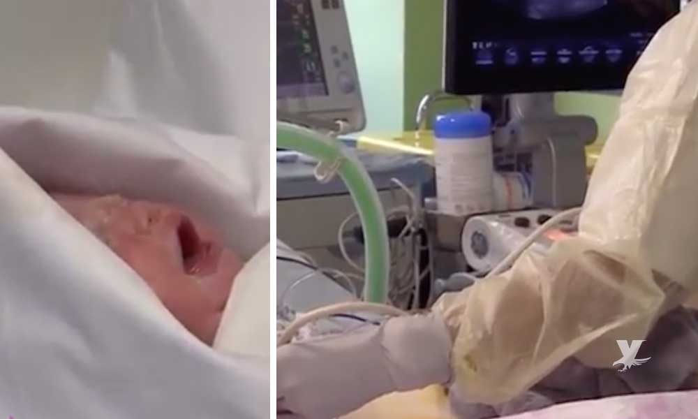 (VIDEO) Mujer con 4 meses de fallecida da a luz a su hijo