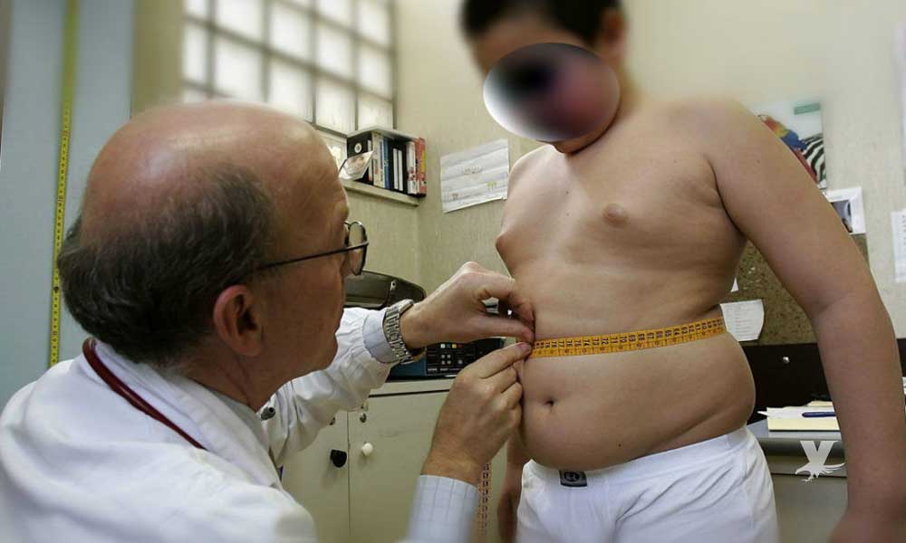 3 de cada 10 menores de edad en Baja California tienen obesidad