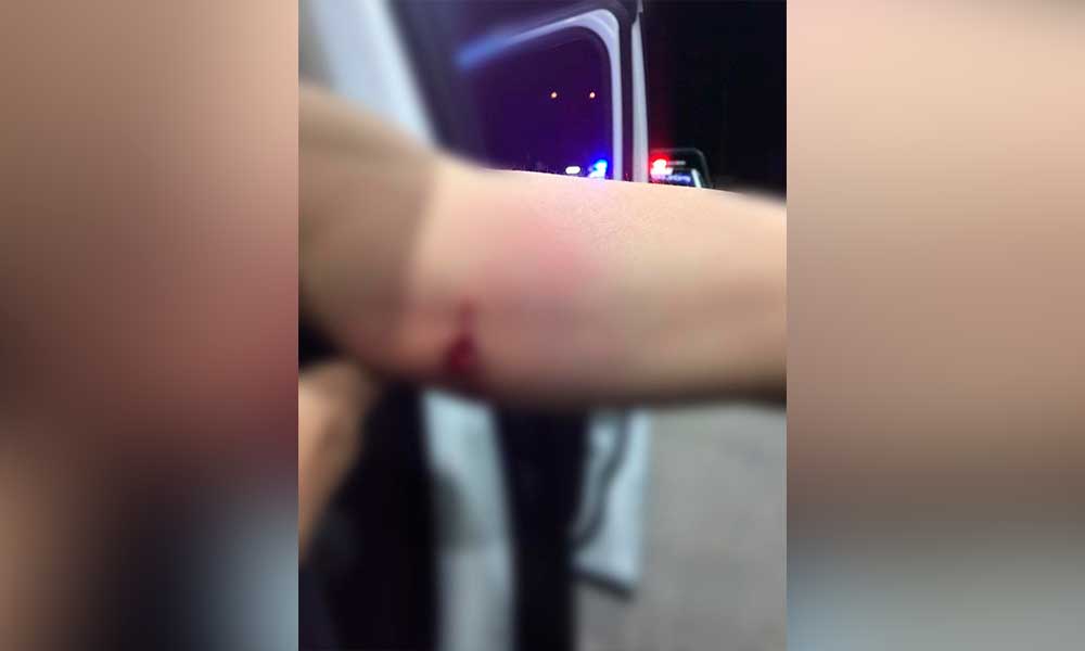 Joven lesionado por arma de fuego, el agresor intentó arebatarle su mochila Tecate