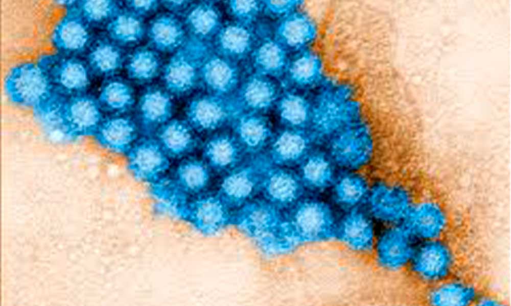 Norovirus pone a temblar; nuevo brote viral que deja 200 infectados