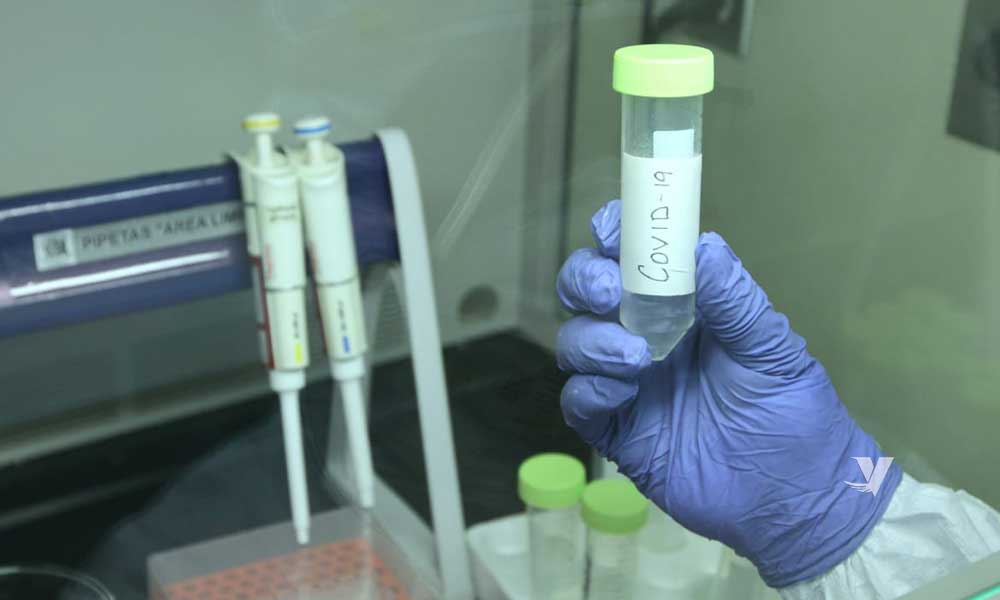 Investigadores del IMSS participan en 3 de las 4 propuestas enviadas al CEPI para el desarrollo de una vacuna contra el COVID-19